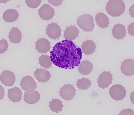 Basófilo série branca do hemograma