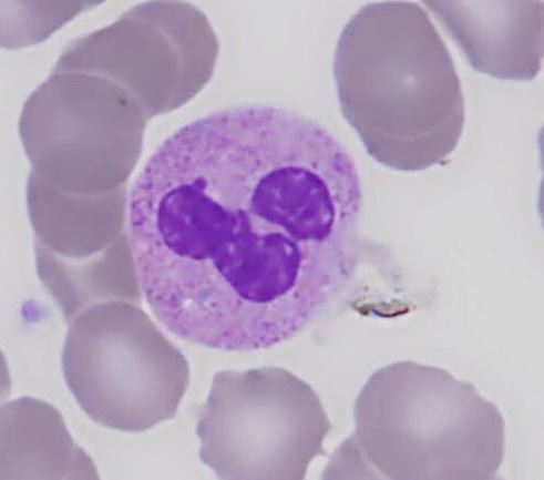 Neutrofilo segmentado série branca hemograma