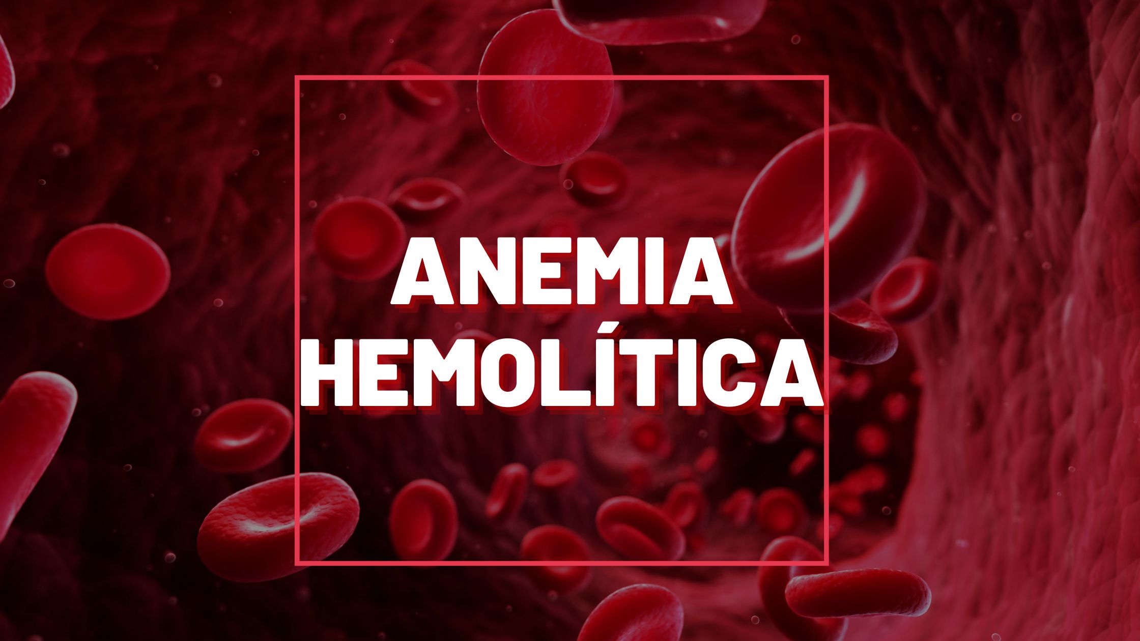 O Que Anemia Hemol Tica Hematologia Na Bancada