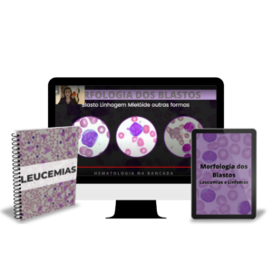 Curso completo Morfologia dos blastos Leucemias e Linfomas