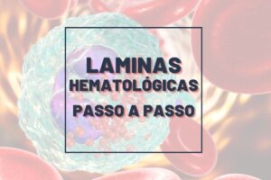 Leitura De L Minas Hematol Gicas Passo A Passo Hematologia Na Bancada