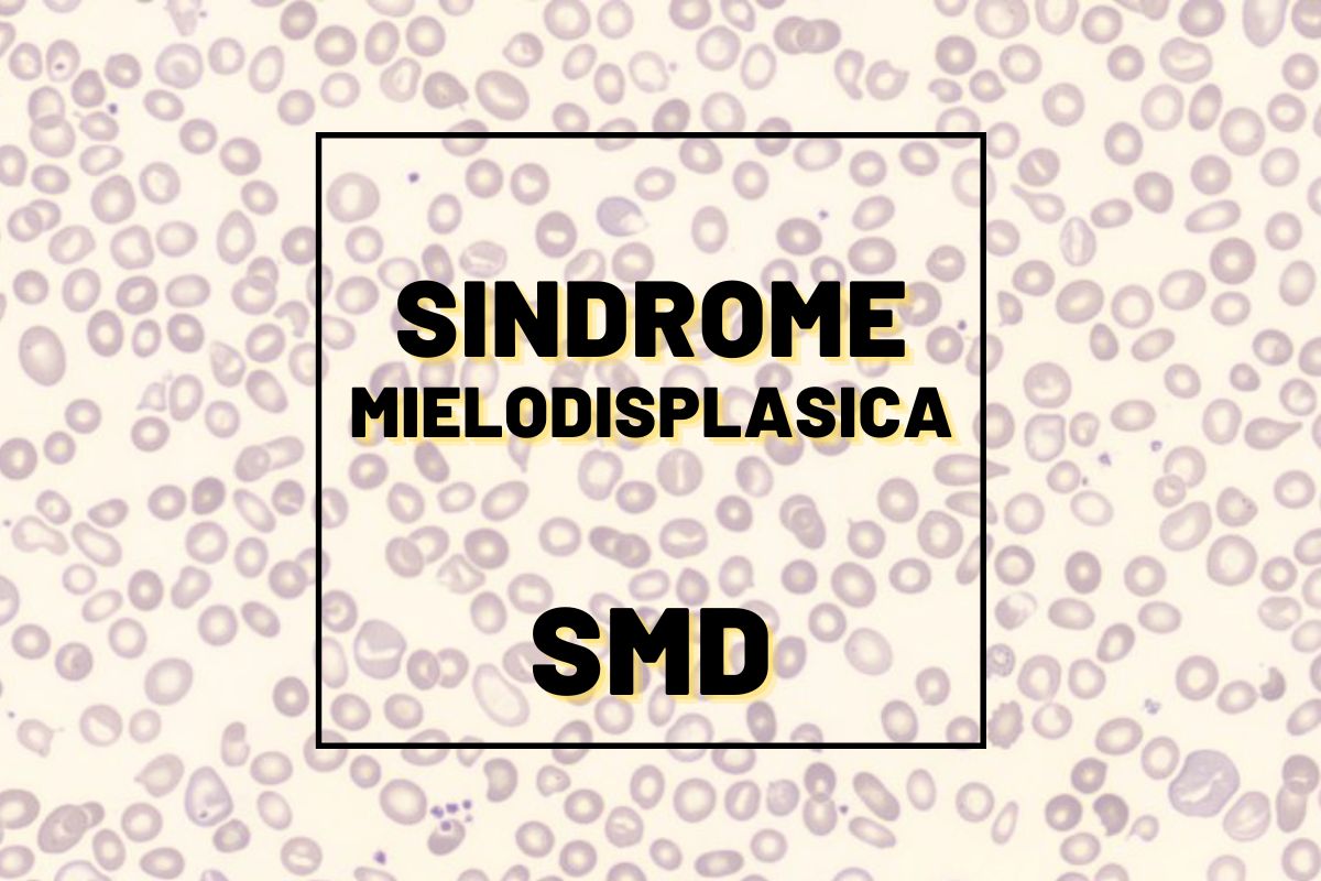 sindrome mielodisplasica