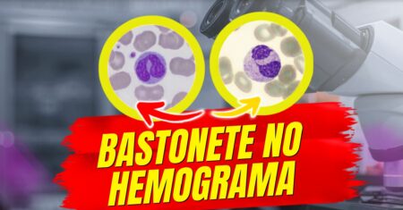 Bastonetes no Hemograma: O que quer dizer? Entenda quando é normal e quando pode indicar uma doença